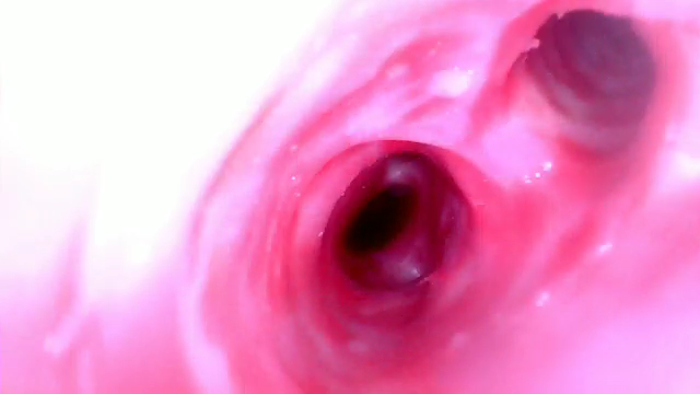 Simulated Bronchoscopy Model